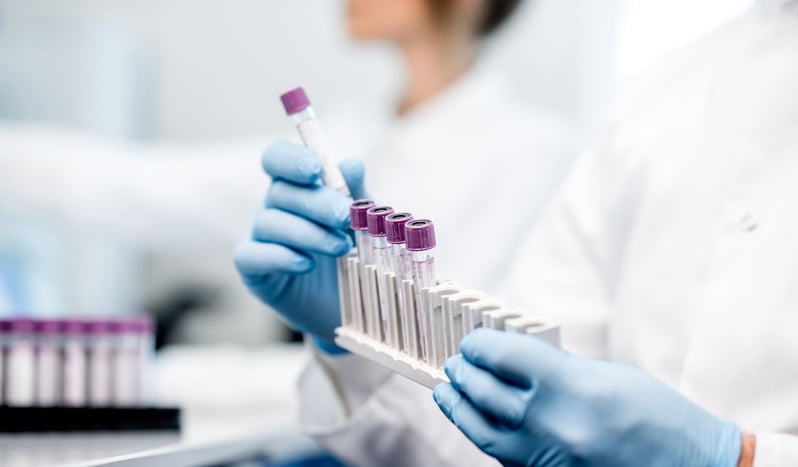 Hematologist examining samples in lab