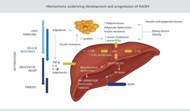 An image showing the mechanisms underlying the development and progression of NASH